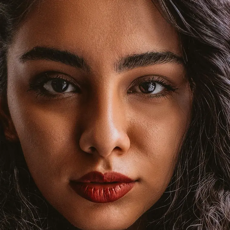 Russian Lips Lippenbehandlung bei MYSSAK Aesthetics in Berlin — Eindruck 4