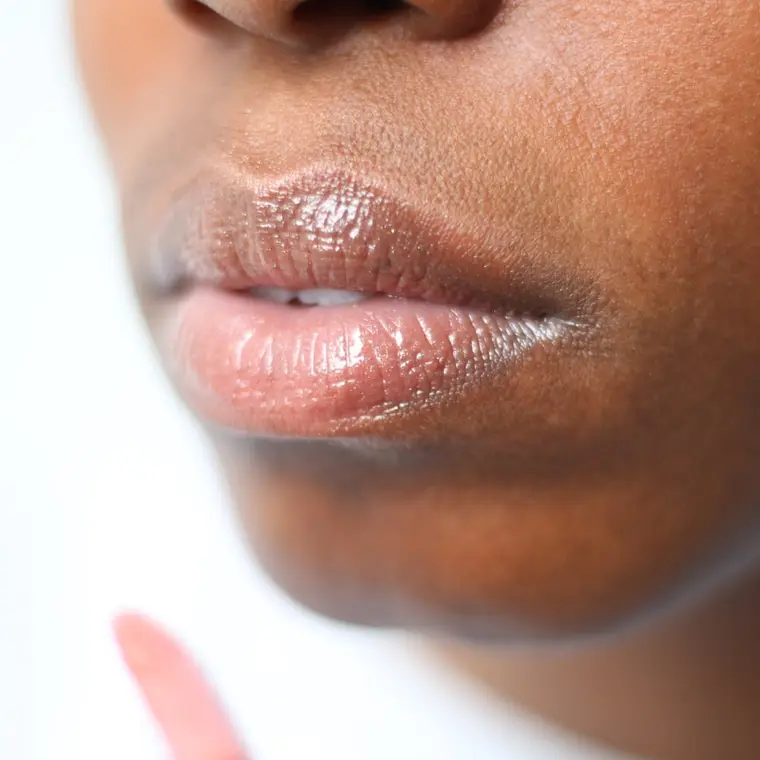 Russian Lips Lippenbehandlung bei MYSSAK Aesthetics in Berlin — Eindruck 9